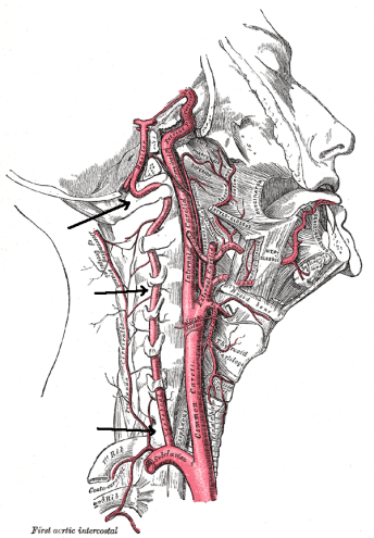 Vertebral_artery
